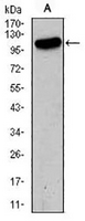 1 - Anti-GLUR2 Antibody AP95845