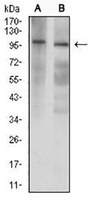 1 - Anti-GRIK3 Antibody AP95846