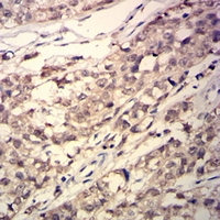 19 - Anti-GSTP1 Antibody AP95849