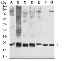 1 - Anti-GSTP1 Antibody AP95849