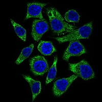 3 - Anti-GUCY1A3 Antibody AP95850