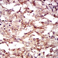 19 - Anti-GUCY1A3 Antibody AP95850