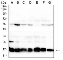 1 - Anti-Histone H2A.X Antibody AP95851