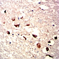 19 - Anti-HAS1 Antibody AP95852