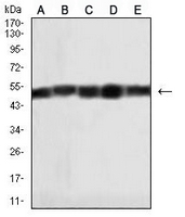 1 - Anti-HAS1 Antibody AP95852