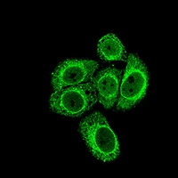 3 - Anti-Histone Deacetylase 1 Antibody AP95853