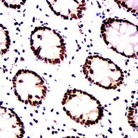 19 - Anti-Histone Deacetylase 1 Antibody AP95853