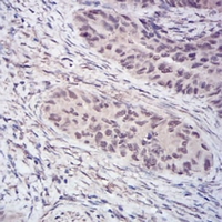 19 - Anti-Histone Deacetylase 2 Antibody AP95854