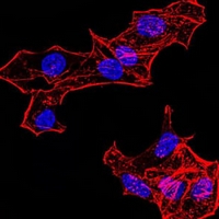 3 - Anti-Histone H4 (MonoMethyl-K20) Antibody AP95856