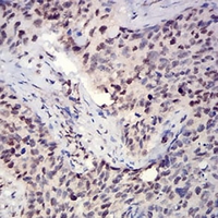 19 - Anti-Histone H3 (Acetyl-K27) Antibody AP95859