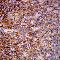 19 - Anti-HLA-B Antibody AP95860