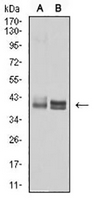 1 - Anti-HLA-B Antibody AP95860
