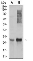 1 - Anti-HLA-DRA Antibody AP95862