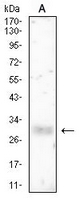 1 - Anti-HLA-DRB1 Antibody AP95863