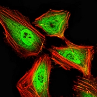 3 - Anti-HNF1 beta Antibody AP95865