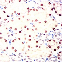 19 - Anti-HNF1 beta Antibody AP95865