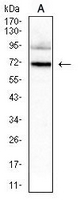 1 - Anti-HNF1 beta Antibody AP95865