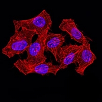 3 - Anti-hnRNP M Antibody AP95866