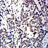 19 - Anti-hnRNP M Antibody AP95866