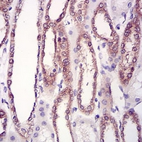 19 - Anti-HPRT Antibody AP95867