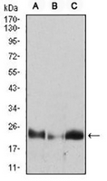 1 - Anti-HPRT Antibody AP95867