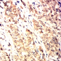 19 - Anti-HSPA4 Antibody AP95869