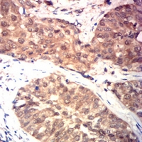 19 - Anti-HSPA4 Antibody AP95870