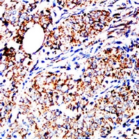 19 - Anti-GRP75 Antibody AP95871