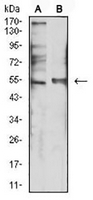 1 - Anti-5-HT3B Antibody AP95873