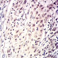 19 - Anti-OMI Antibody AP95874