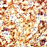 19 - Anti-IFNAR1 Antibody AP95877