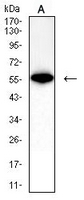 1 - Anti-IFNAR1 Antibody AP95877