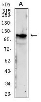 1 - Anti-IGF1 Receptor Antibody AP95878