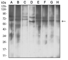 1 - Anti-IGF2BP3 Antibody AP95879