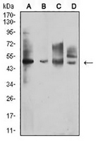 1 - Anti-CD213a1 Antibody AP95882