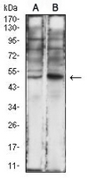 1 - Anti-IL-1R2 Antibody AP95884