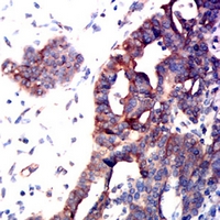 19 - Anti-CD126 Antibody AP95887