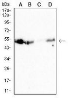 1 - Anti-CD126 Antibody AP95887