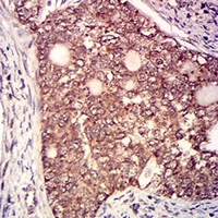 19 - Anti-CD130 Antibody AP95888