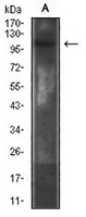 1 - Anti-CD130 Antibody AP95888