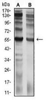 1 - Anti-CD129 Antibody AP95890