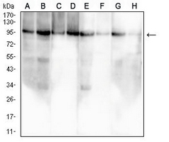 1 - Anti-Insulin Receptor Antibody AP95891