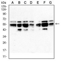1 - Anti-IRF3 Antibody AP95892
