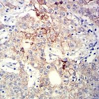 19 - Anti-CD104 Antibody AP95898