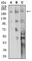 1 - Anti-CD104 Antibody AP95898