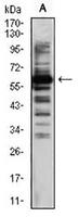 1 - Anti-TIP60 Antibody AP95902