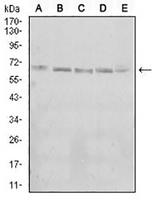 1 - Anti-KBTBD8 Antibody AP95903