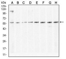 1 - Anti-KCNN4 Antibody AP95904