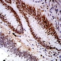 19 - Anti-KDM1A Antibody AP95905