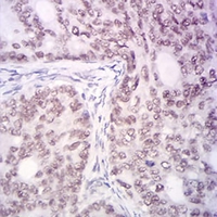 19 - Anti-KDM1A Antibody AP95906